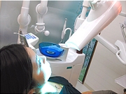 オフィスホワイトニング機材「ビヨンド」