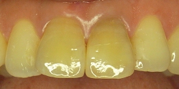 色が違い目立っている状態