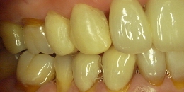 色が違い目立っている状態