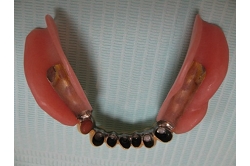 マグネットデンチャー