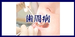 歯周病へのメニューボタン